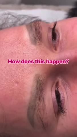 Before and after: Tattoo removal, brows