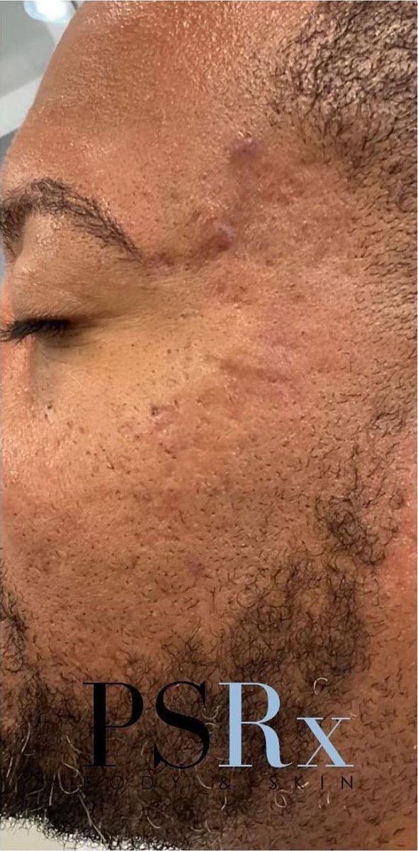 After: Scars, face