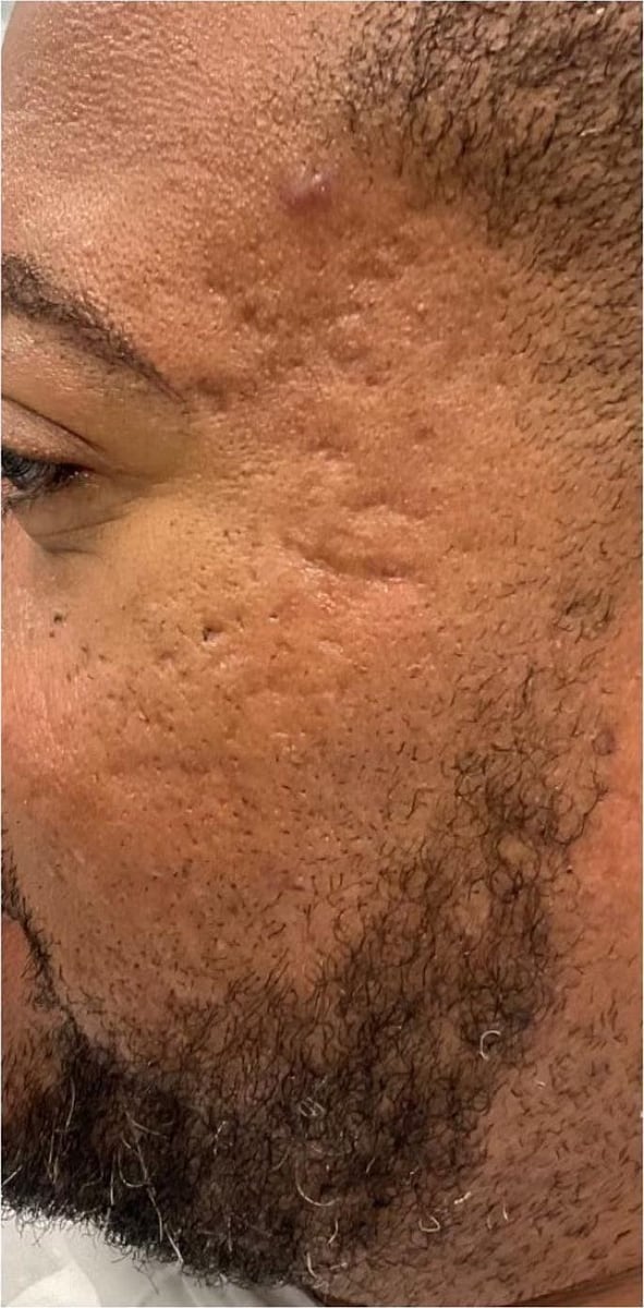 Before: Scars, face