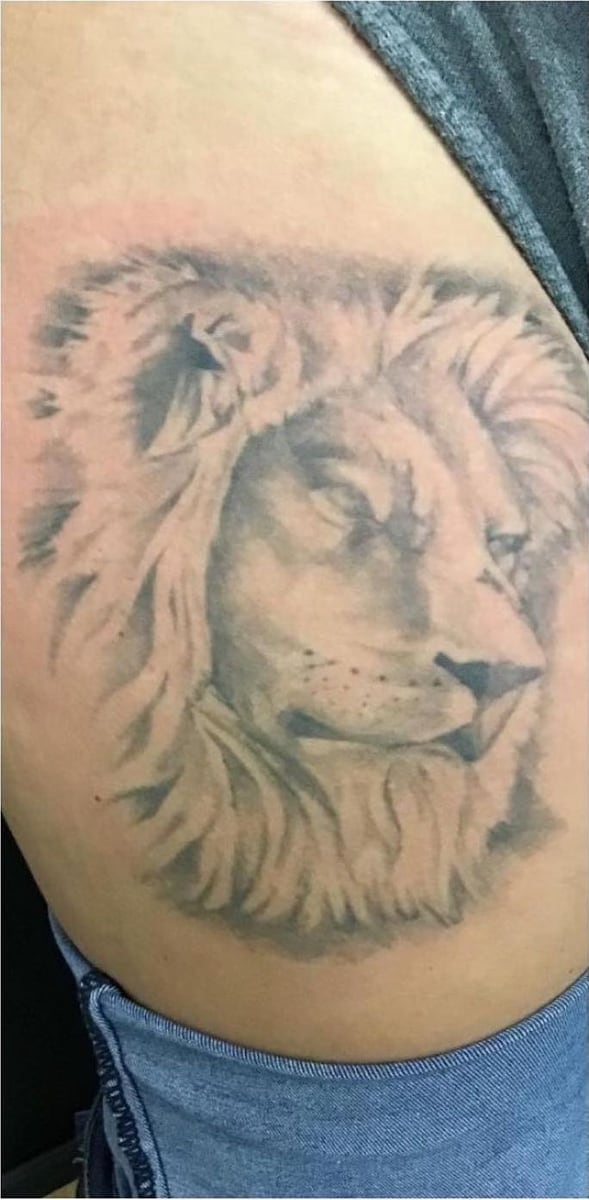 Before: Tattoo removal, legs