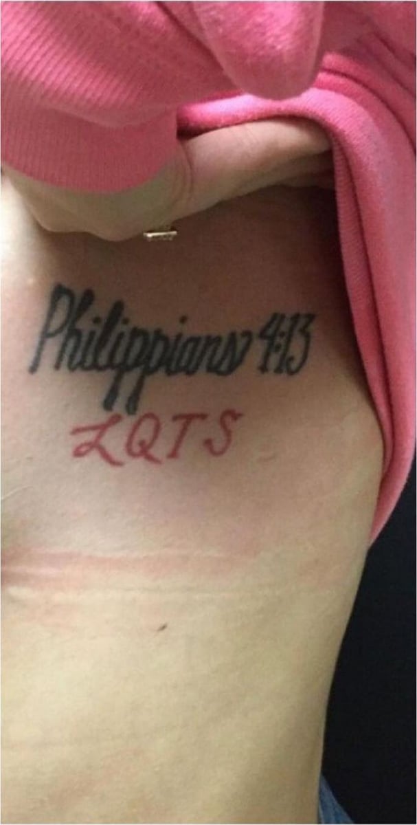 Before: Tattoo removal, chest