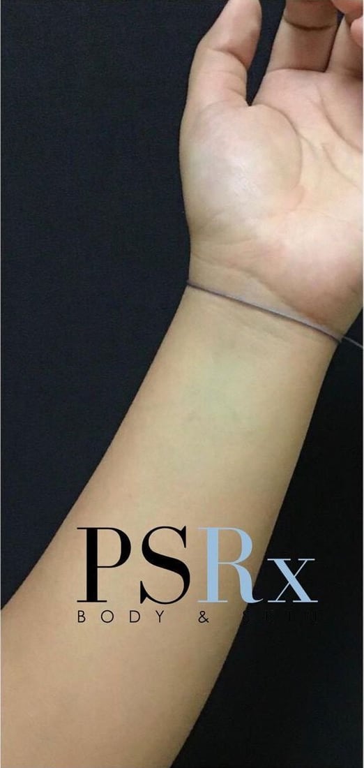 After: Blue wrist tattoo