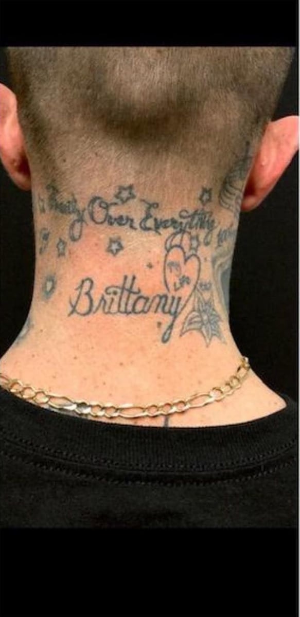 Before: Tattoo removal, neck