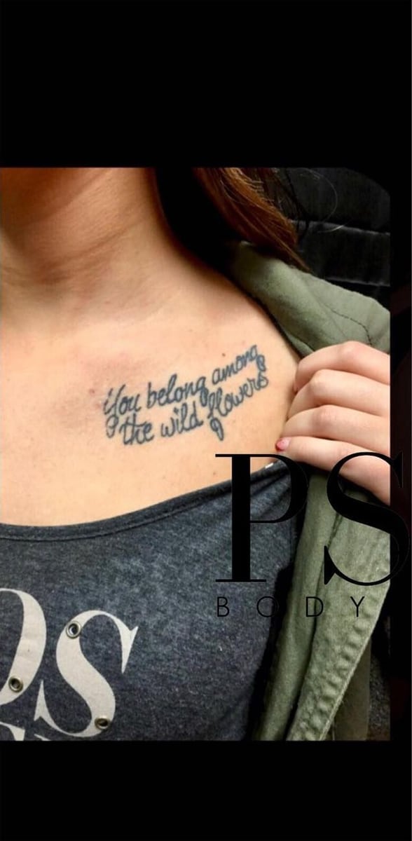 Before: Tattoo removal, chest