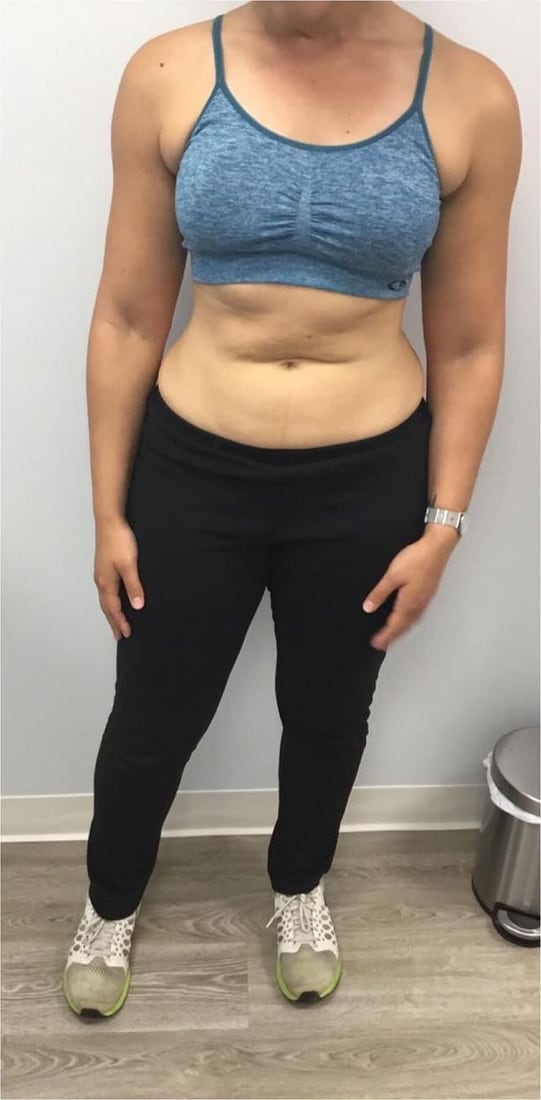 Before: Waist and abdomen